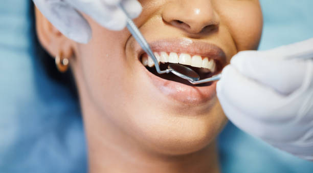 Best Knocked-Out Tooth Emergency  in Wellsburg, WV